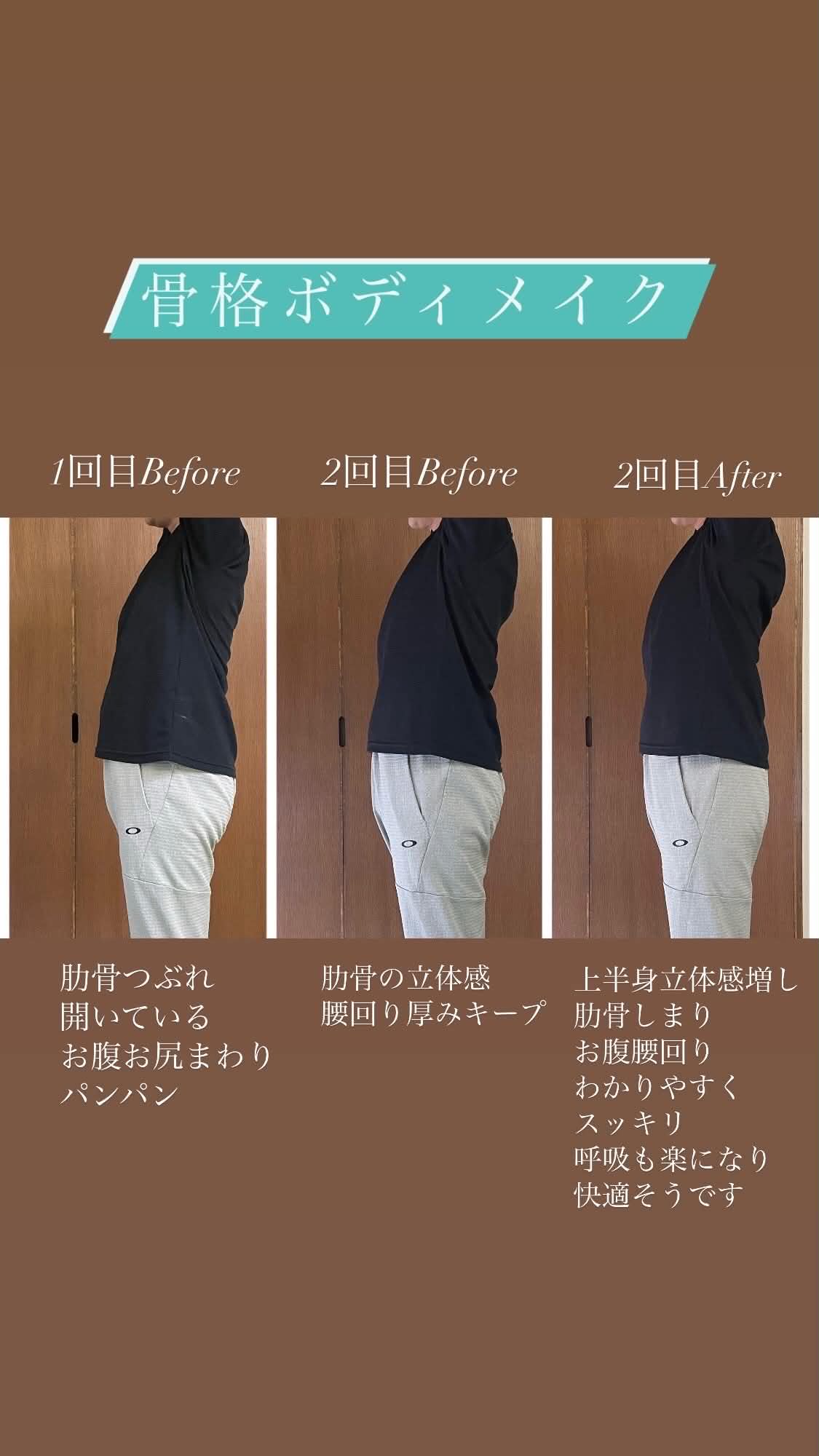 骨格ボディメイクを複数回受けた姿勢の変化